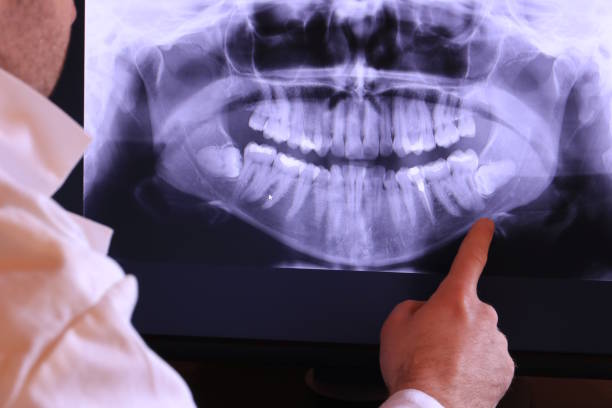 Best Emergency Root Canal Treatment in Fair Plain, MI