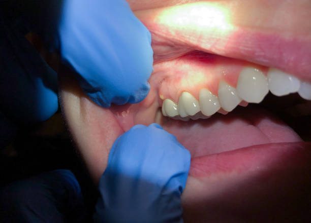 Best Walk-In Emergency Dentist in Fair Plain, MI