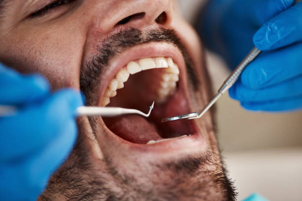 Best Urgent Dental Care in Fair Plain, MI