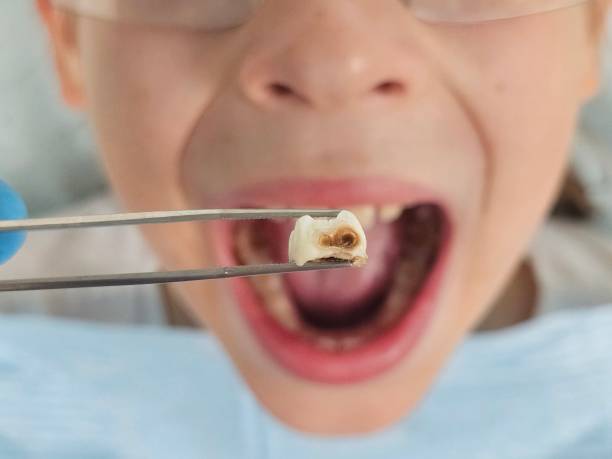 Best Emergency Treatment for Toothache in Fair Plain, MI