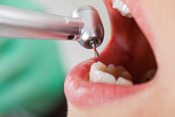 Best Emergency Treatment for Toothache in Fair Plain, MI